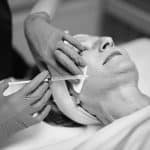 Dermal Fillers
