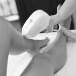 Hair Removal