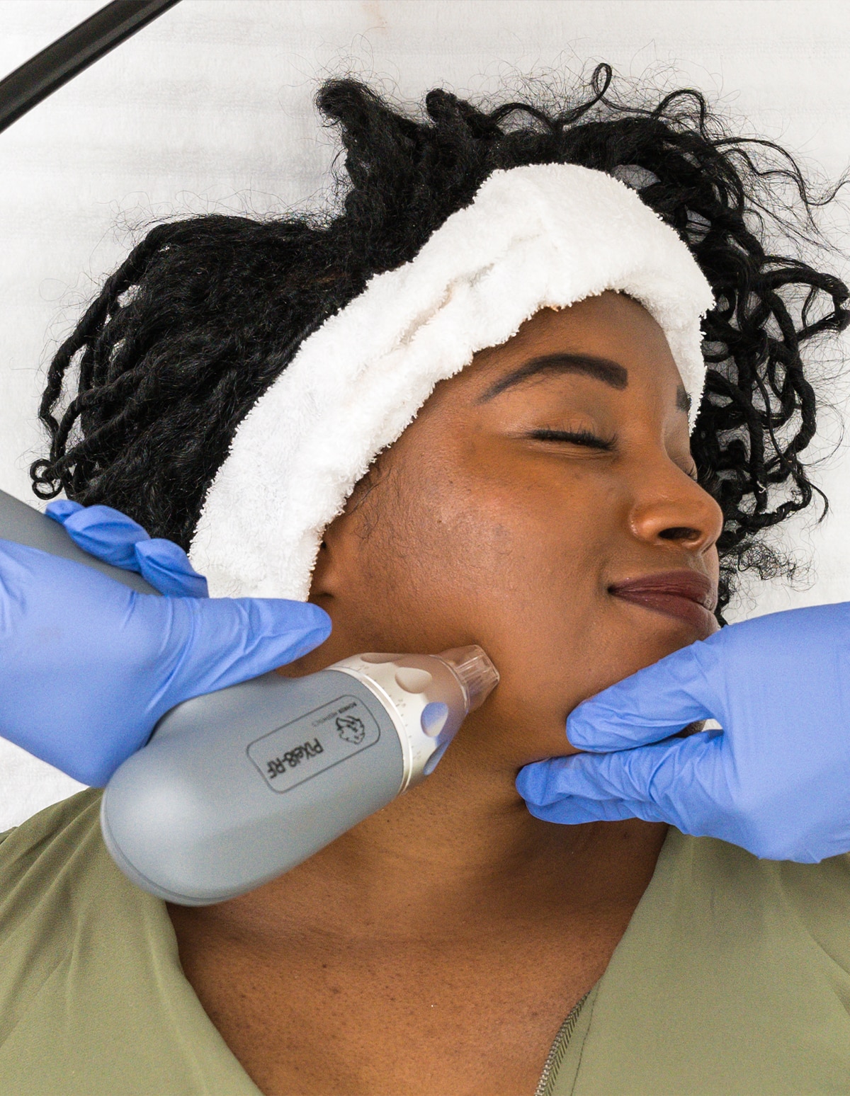 Microneedling