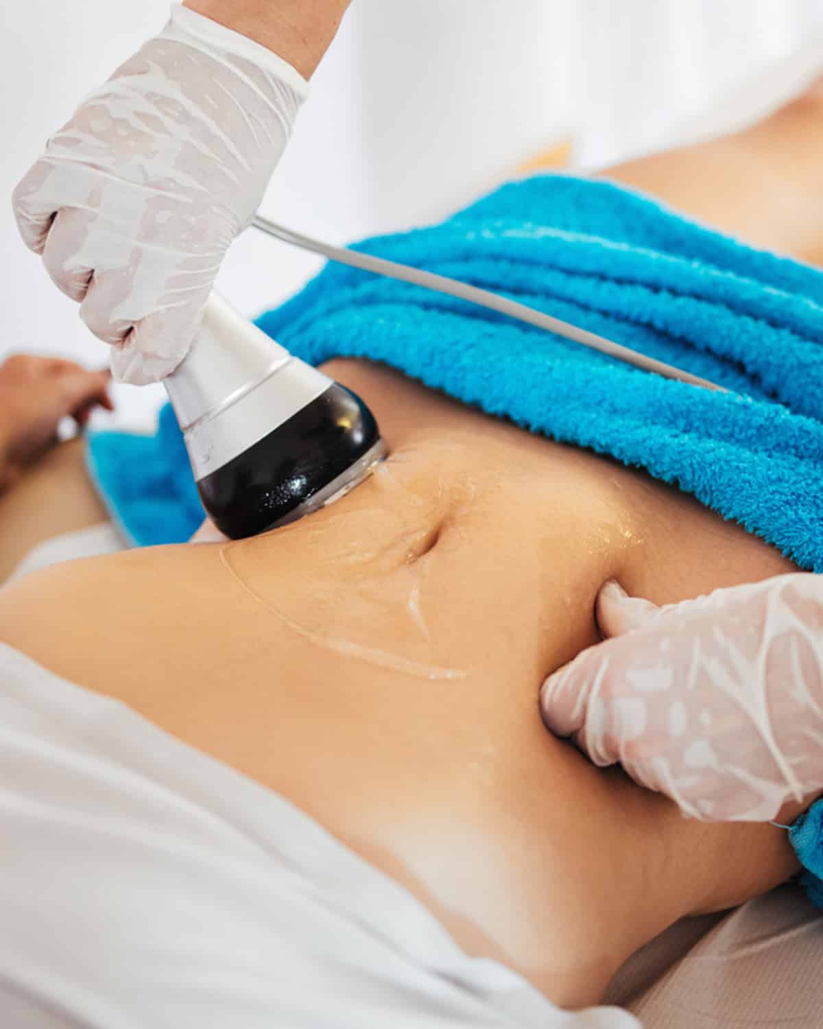 Fat Reduction treatment