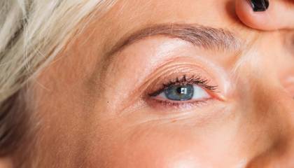 How Do I Treat Hollowed Temples And The Under Eye Area?