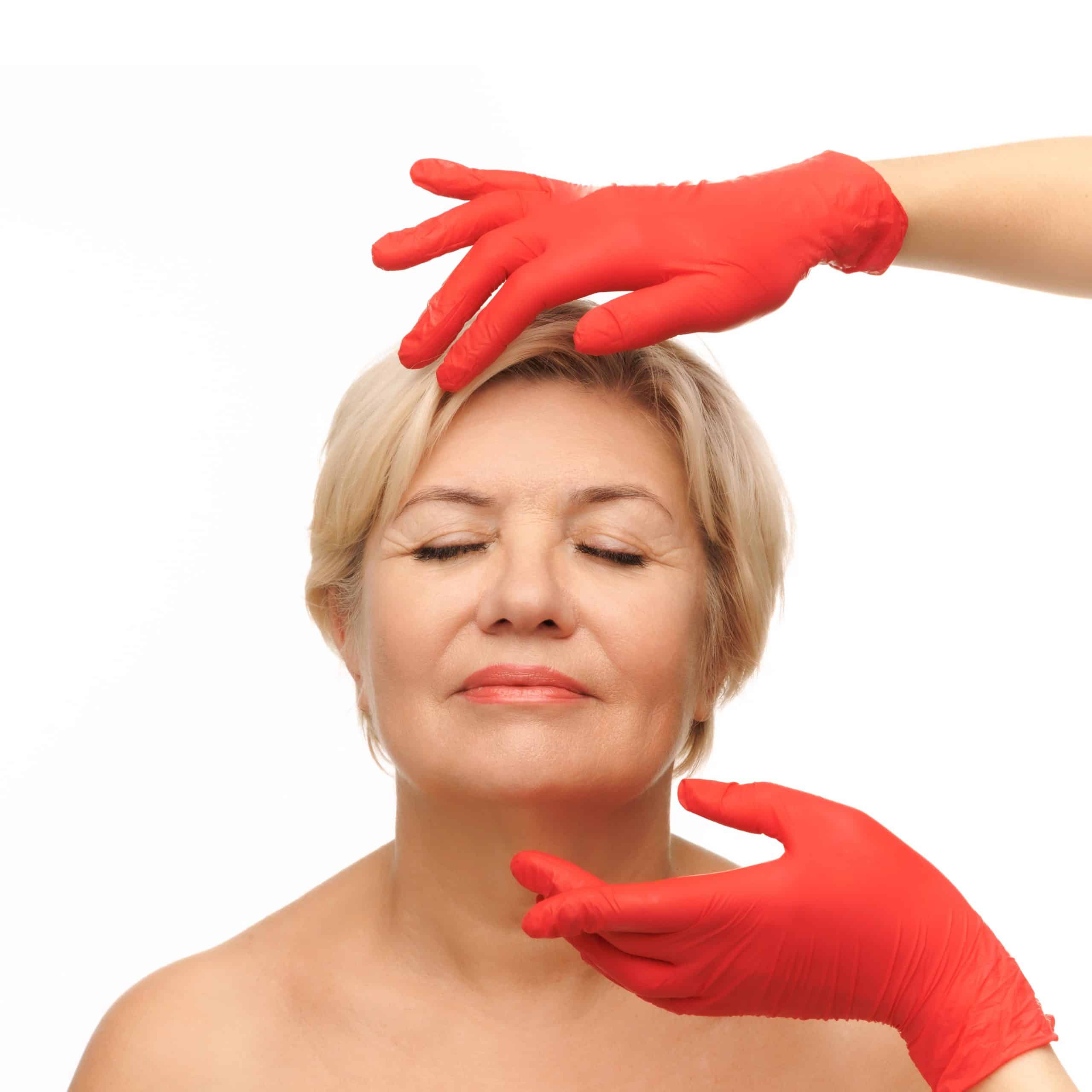 fat grafting procedure transfers fat from other areas to use as a filler for fine lines and facial wrinkles